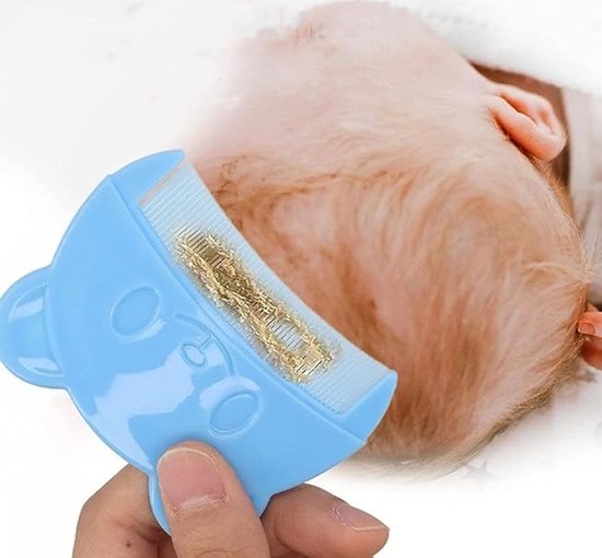 Baby Hoofdkam I Bergkam I Hoofdvet, Schilfers & Vuil Verwijderen I Hoofdhuid Cleaner I Kunststof I Kleur Assorti van SimplyGood.