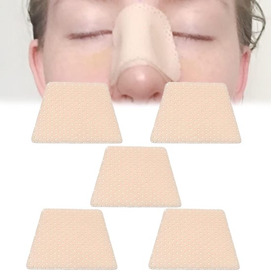 neusspalken - Neus externe ondersteuning beschermer voor neus brace breuk, rinopla-sty Septopla-sty, ENT, Orthop-edische Immob-ilization, 5 STKS (M)